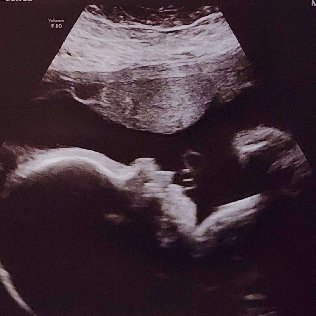 Photo shared by SANDRA for their Babylist baby registry.