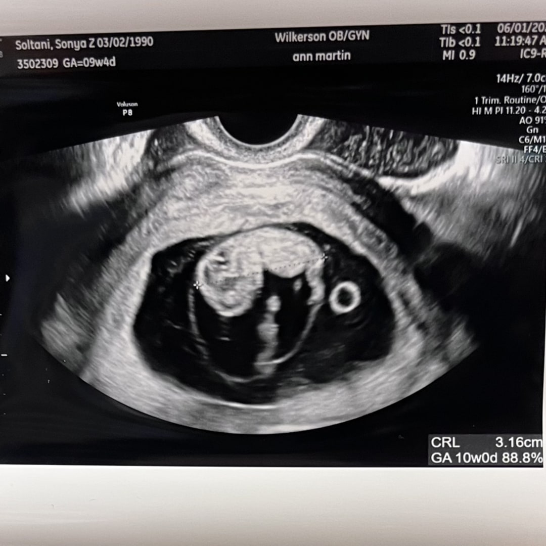 Photo shared by Sonya for their Babylist baby registry.