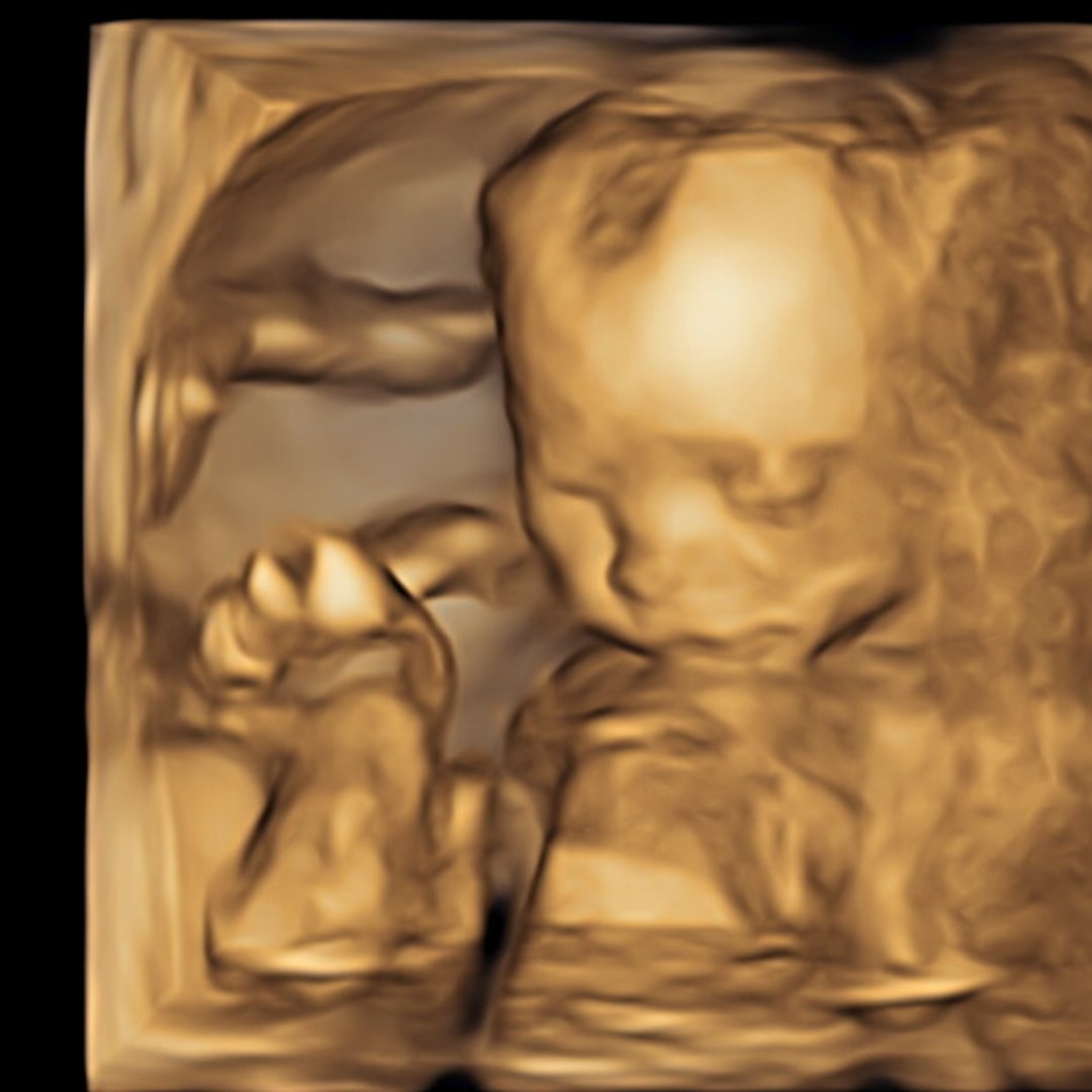 Photo shared by Christiana for their Babylist baby registry.