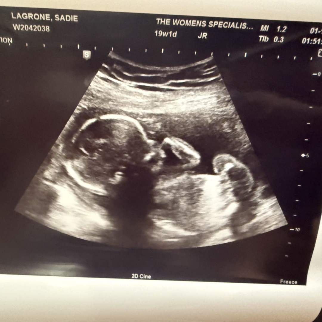 Photo shared by Sadie for their Babylist baby registry.