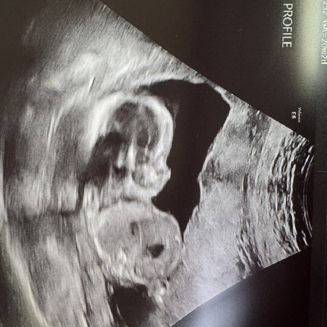Photo shared by Angie for their Babylist baby registry.
