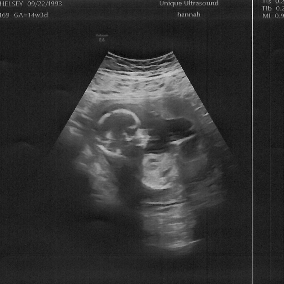 Photo shared by Chelsey for their Babylist baby registry.