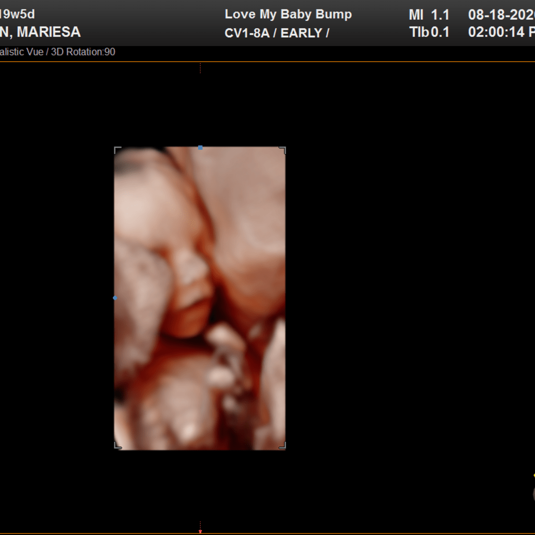 Photo shared by Mariesa for their Babylist baby registry.
