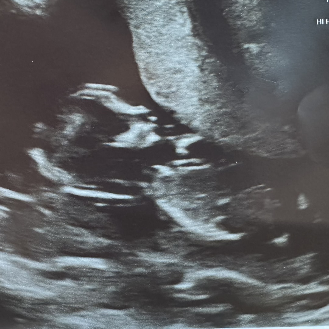 Photo shared by Elizabeth for their Babylist baby registry.