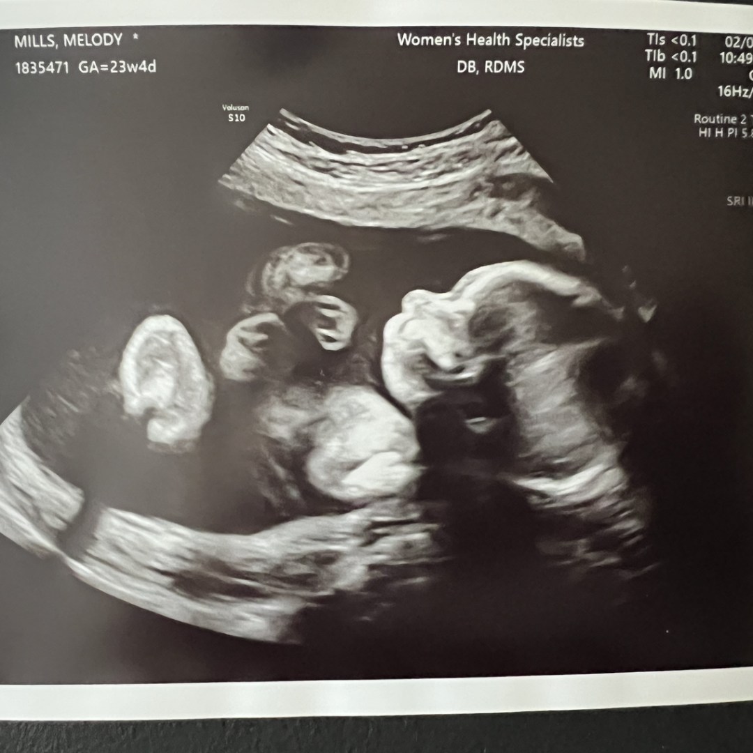 Photo shared by Melody for their Babylist baby registry.