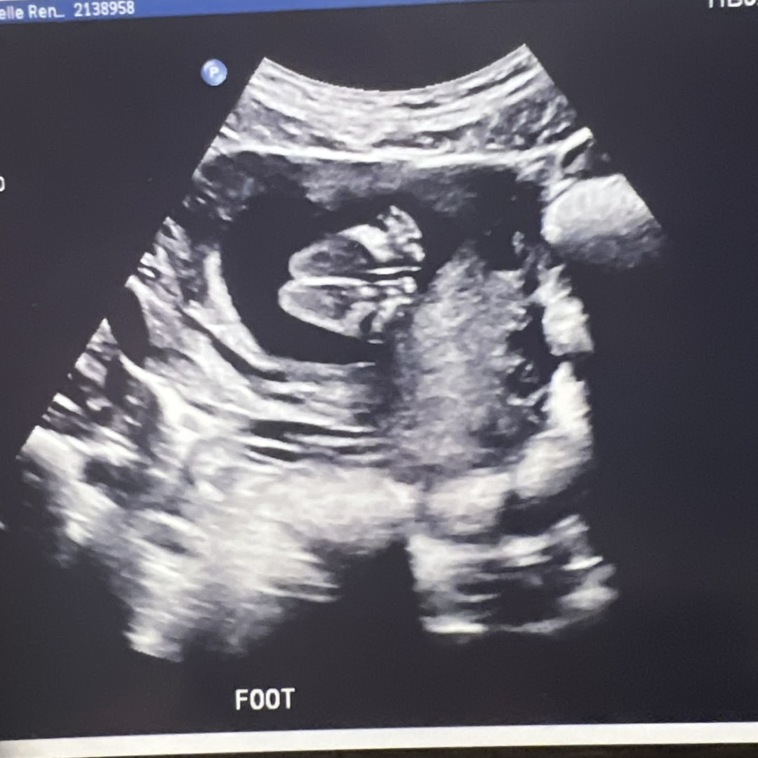 Photo shared by Gabrielle for their Babylist baby registry.