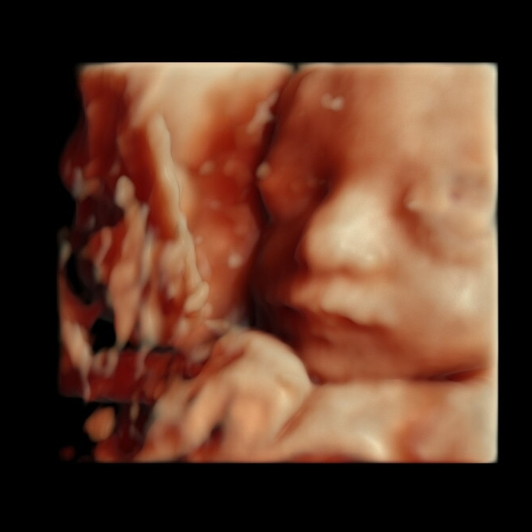 Photo shared by Kelsey for their Babylist baby registry.