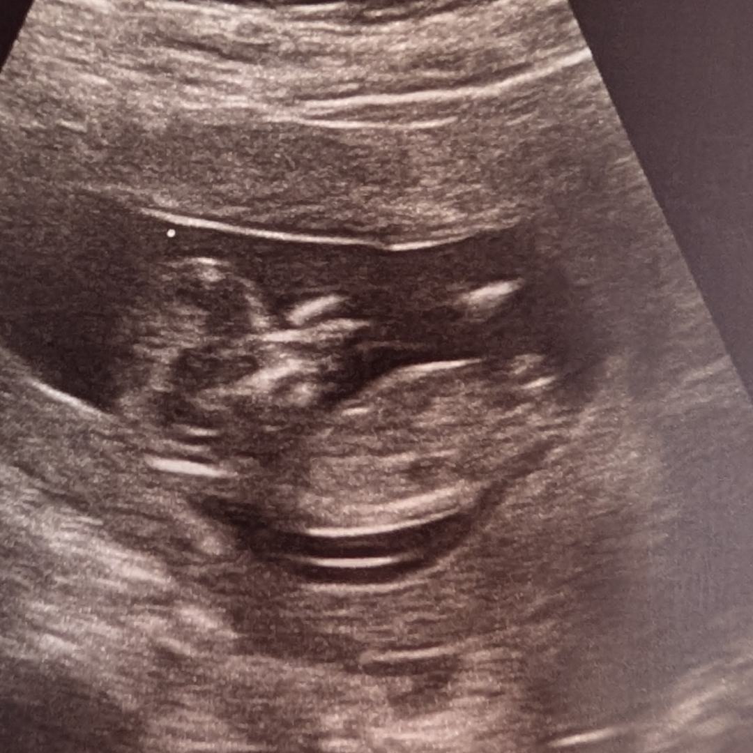 Photo shared by Kaitlyn for their Babylist baby registry.