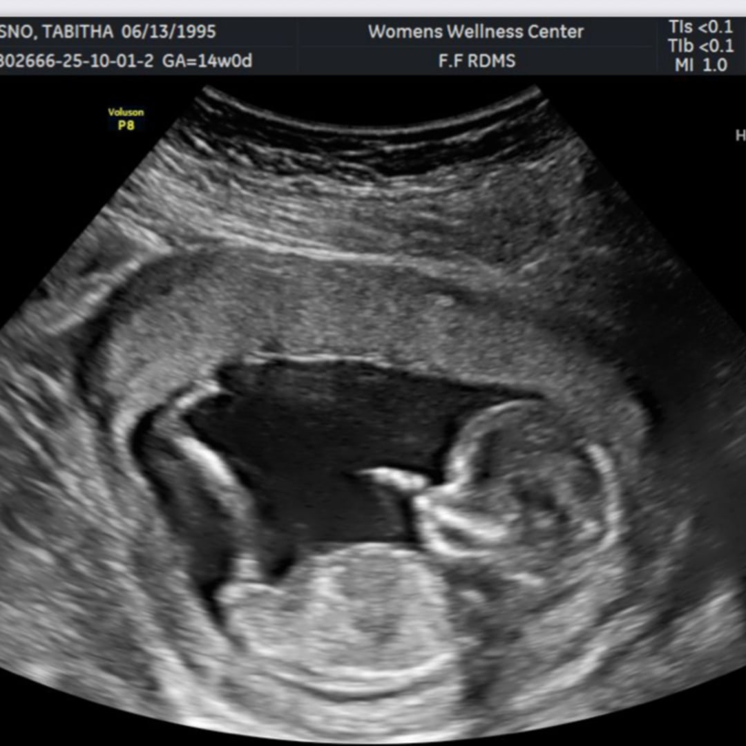 Photo shared by Tabitha for their Babylist baby registry.