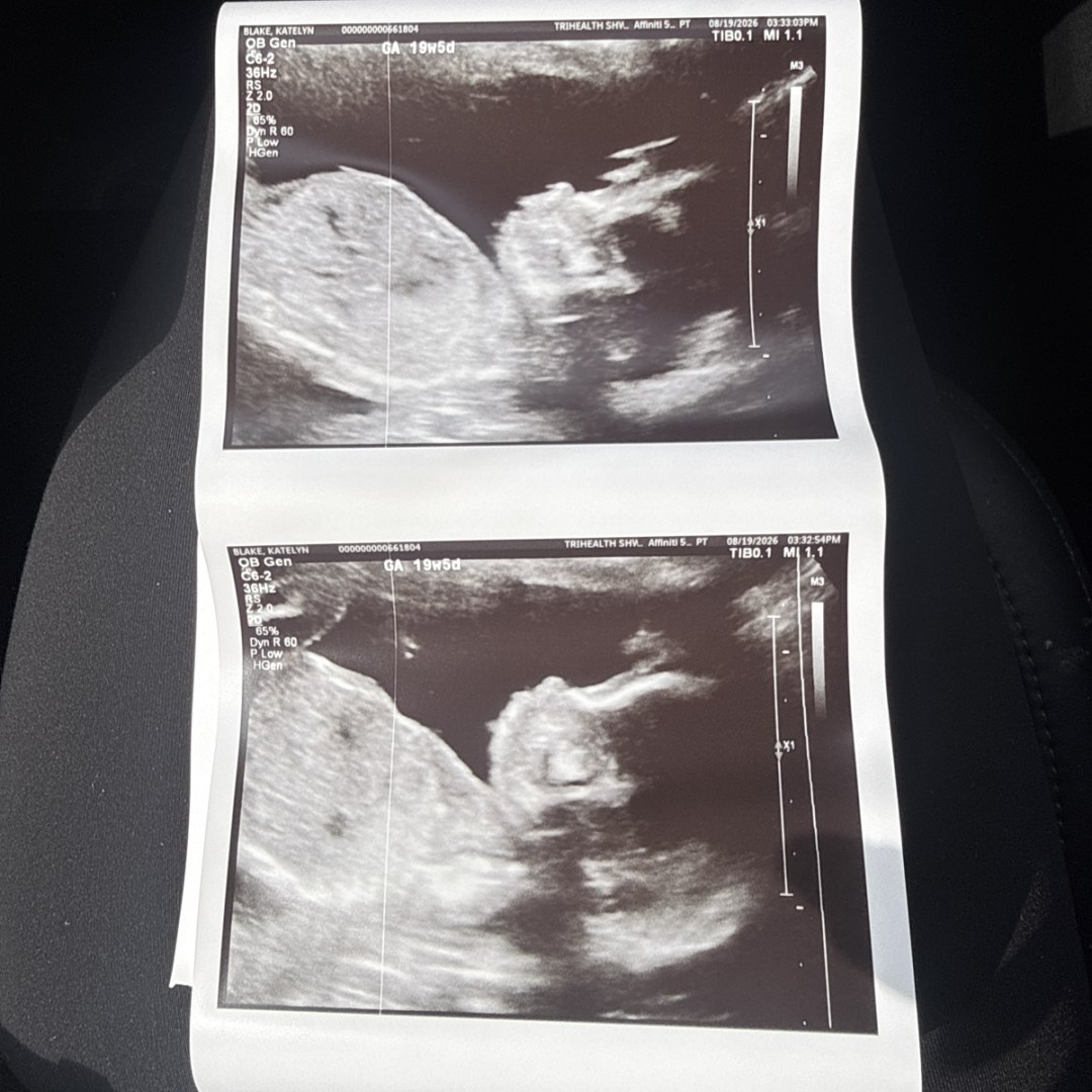 Photo shared by Katelyn for their Babylist baby registry.