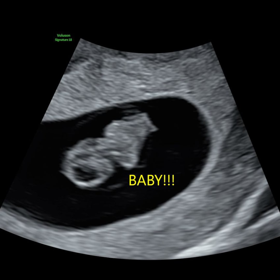 Photo shared by Sidney for their Babylist baby registry.