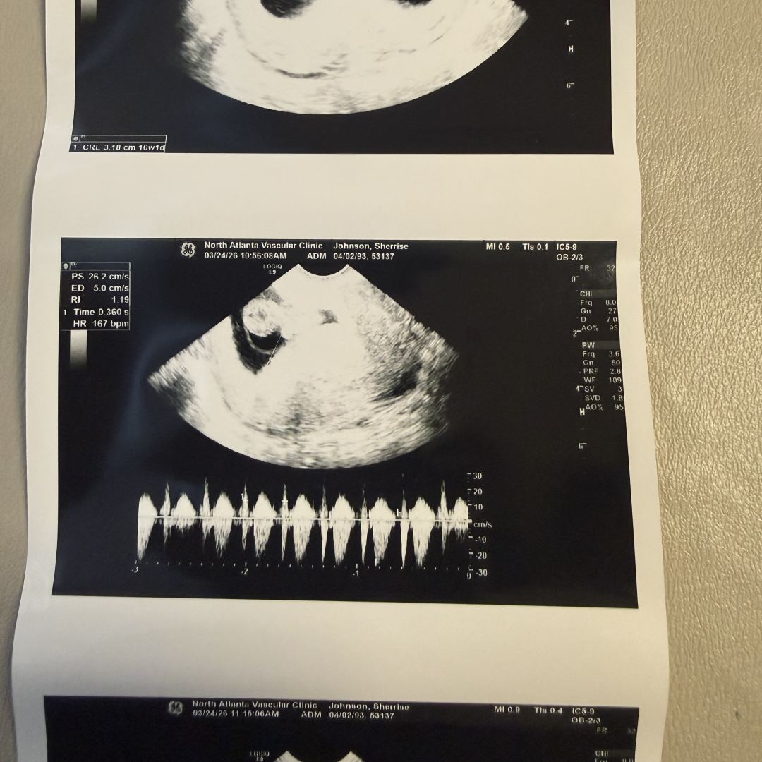 Photo shared by Sherrise for their Babylist baby registry.
