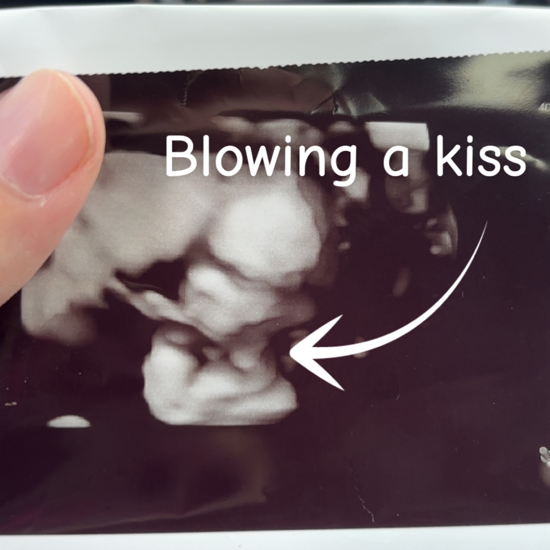 Photo shared by Isabelle for their Babylist baby registry.