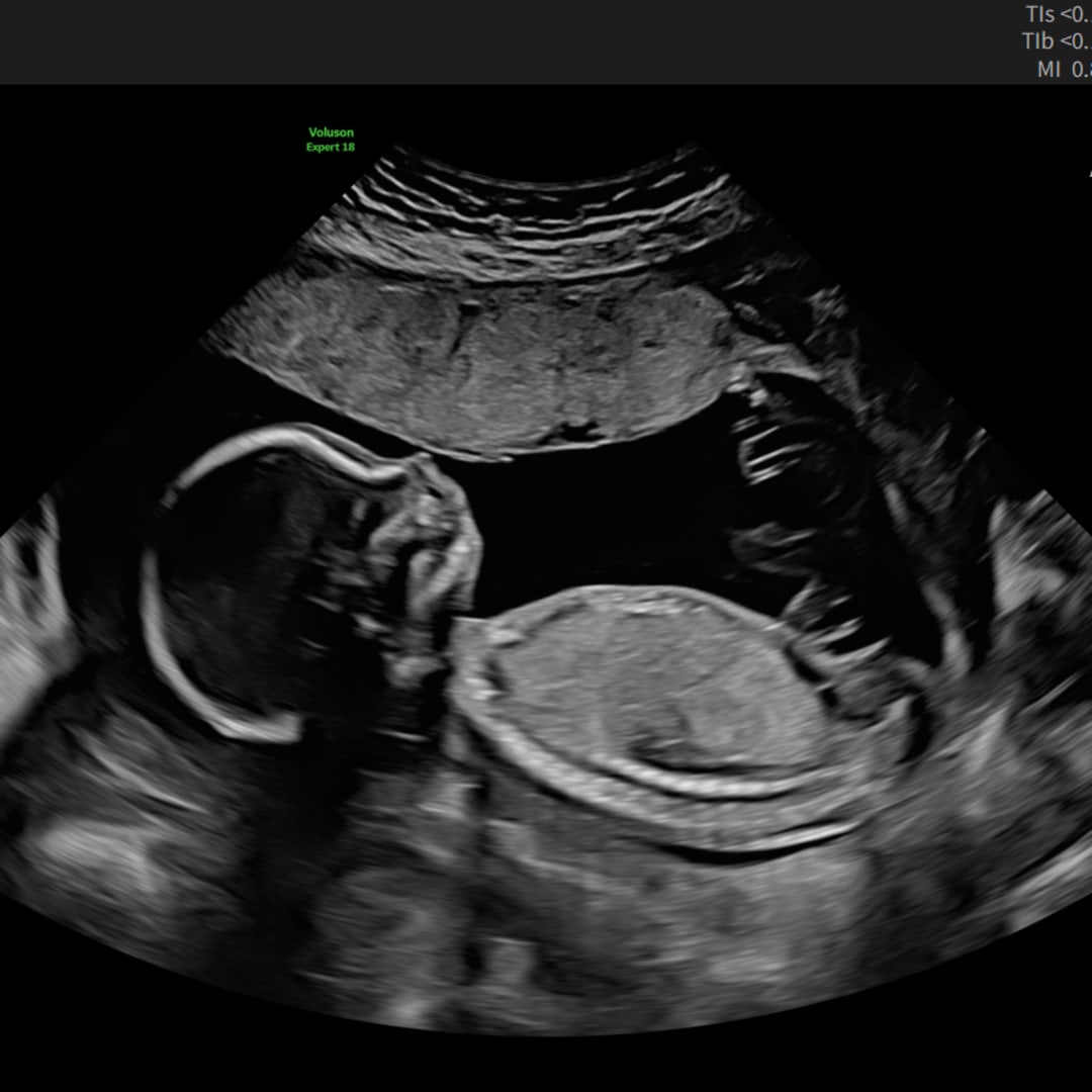 Photo shared by Katie for their Babylist baby registry.