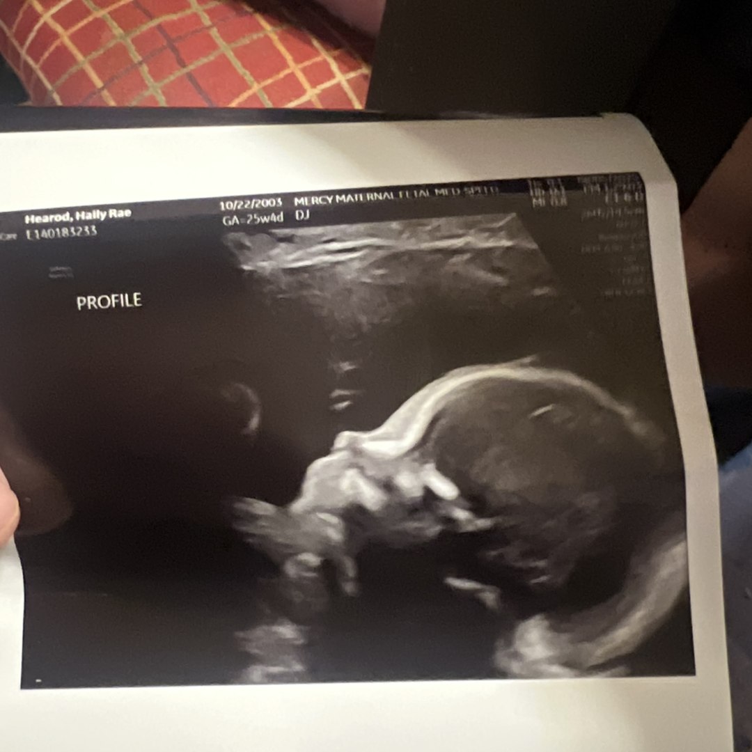 Photo shared by Haily for their Babylist baby registry.