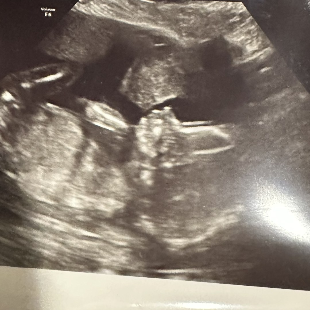 Photo shared by Courtney for their Babylist baby registry.