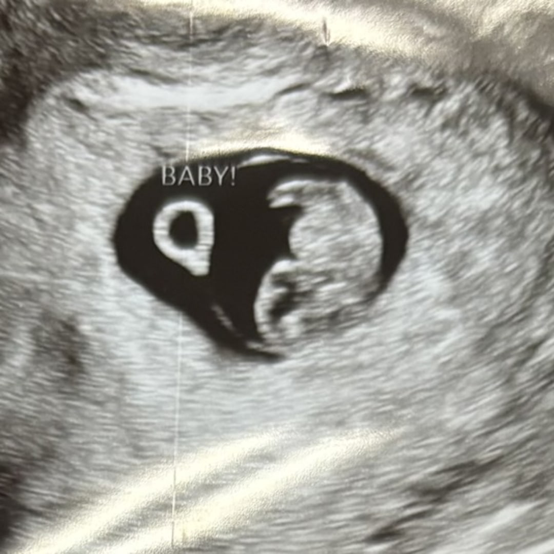 Photo shared by Katelyn for their Babylist baby registry.