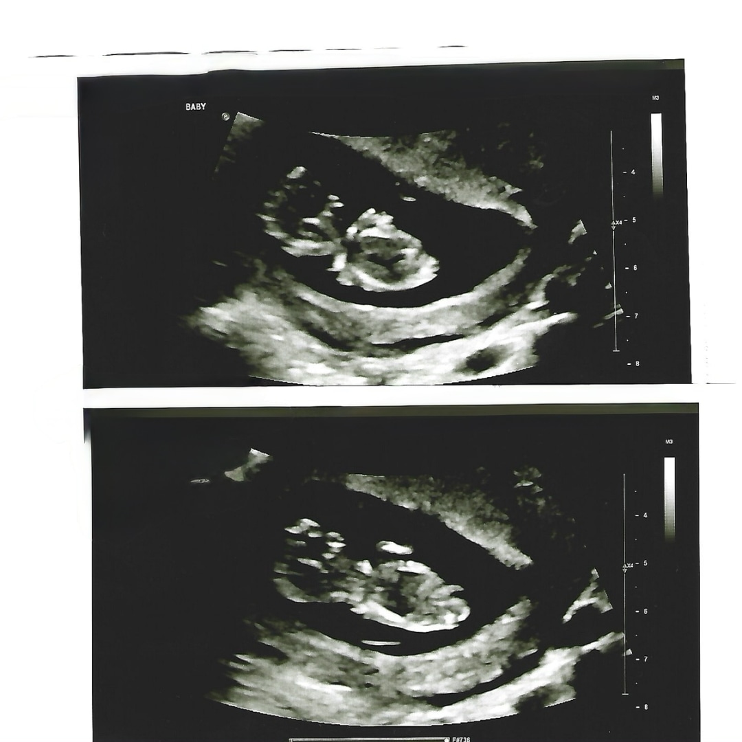 Photo shared by Whitney for their Babylist baby registry.