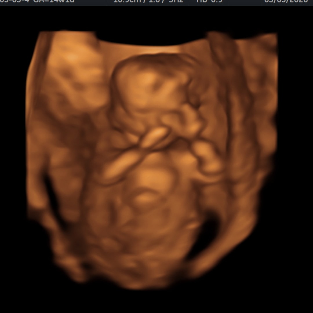Photo shared by Arisleydis for their Babylist baby registry.