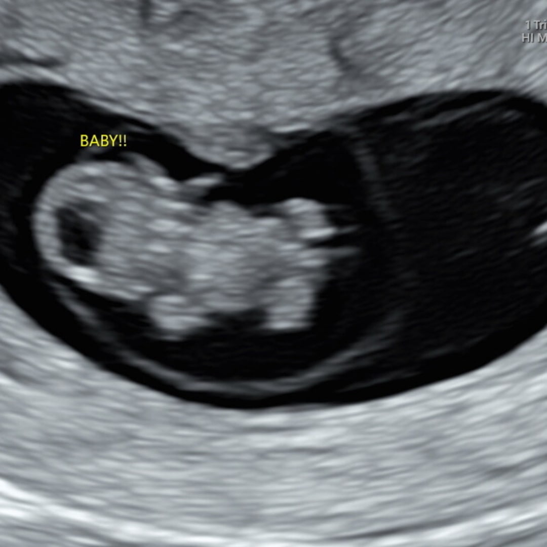 Photo shared by Isabel for their Babylist baby registry.