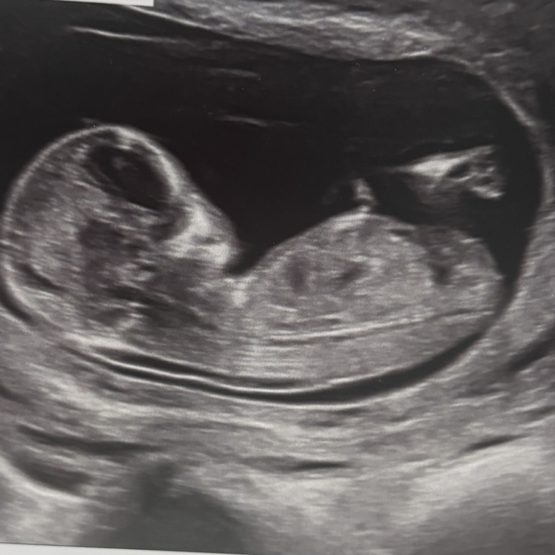 Photo shared by Liron for their Babylist baby registry.