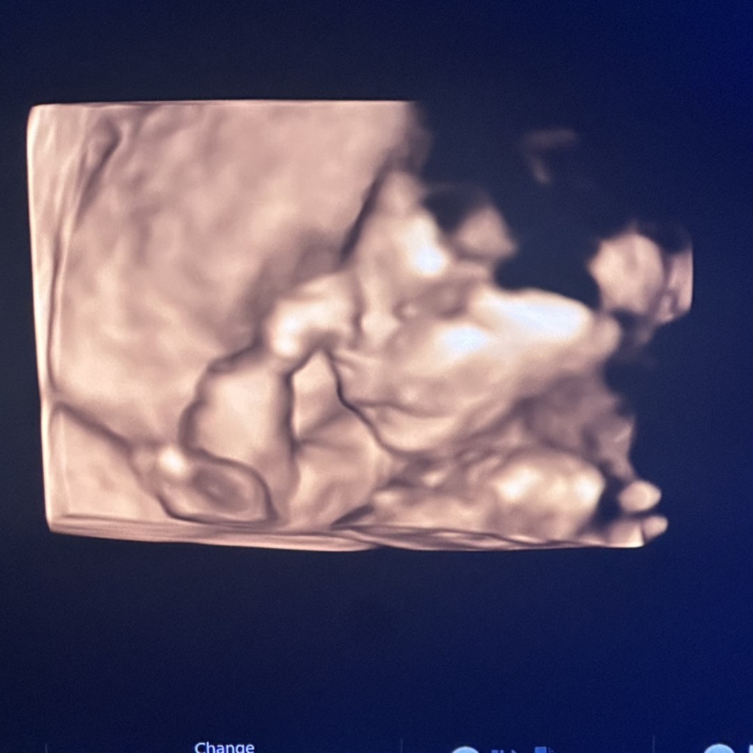 Photo shared by Alexea for their Babylist baby registry.
