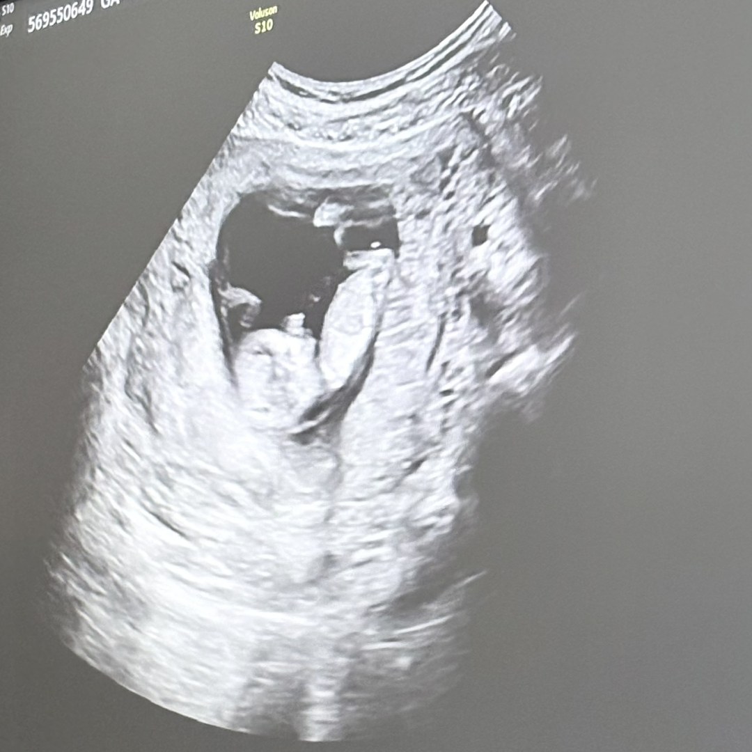 Photo shared by Trinity for their Babylist baby registry.