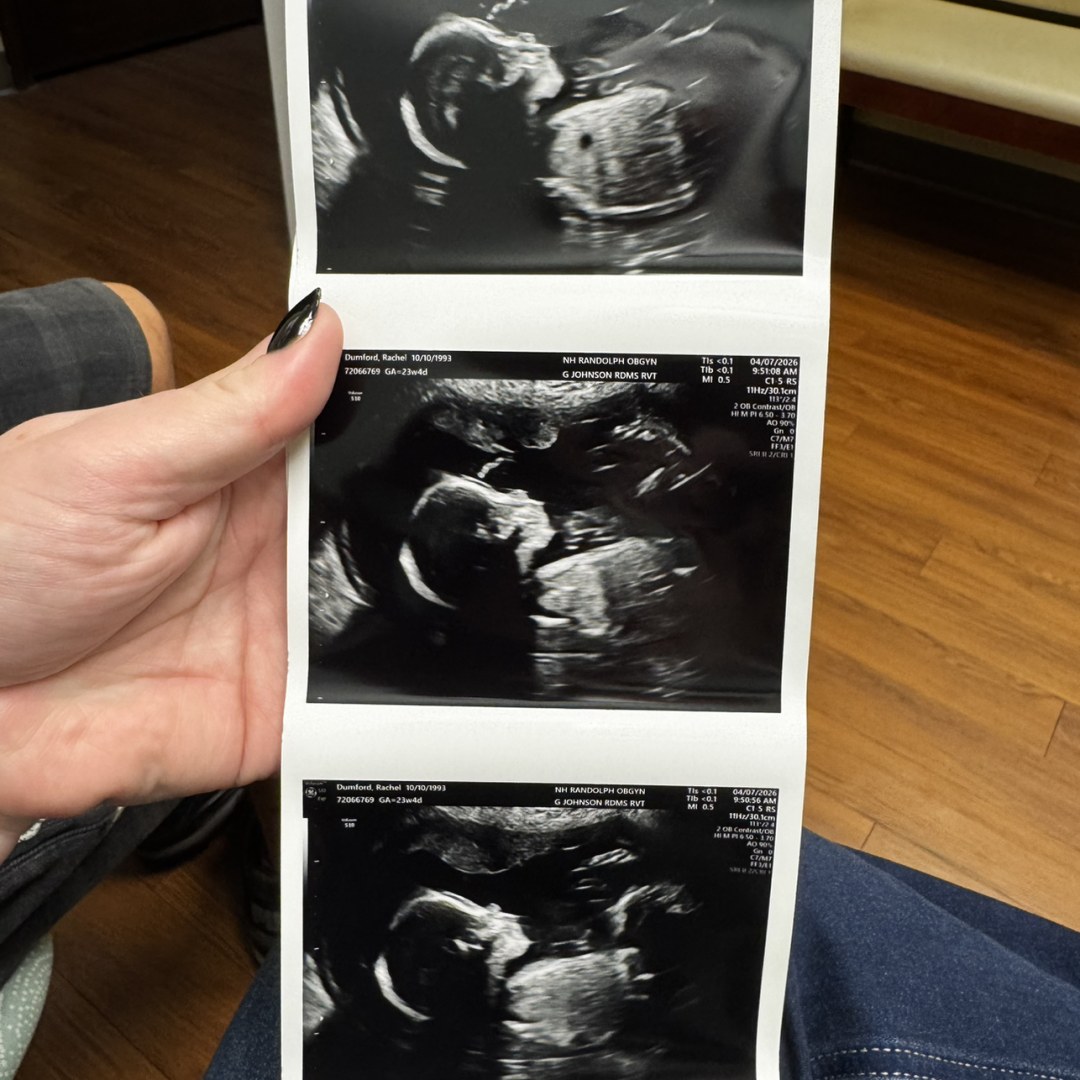 Photo shared by Rachel for their Babylist baby registry.