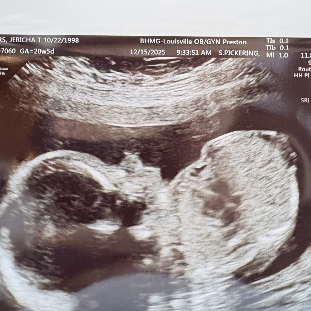 Photo shared by Taylor for their Babylist baby registry.