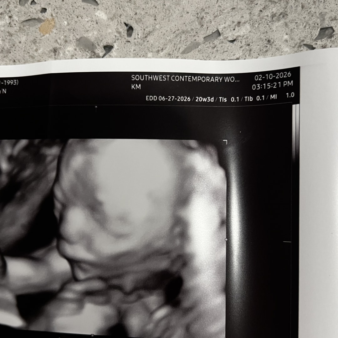 Photo shared by Breanna for their Babylist baby registry.