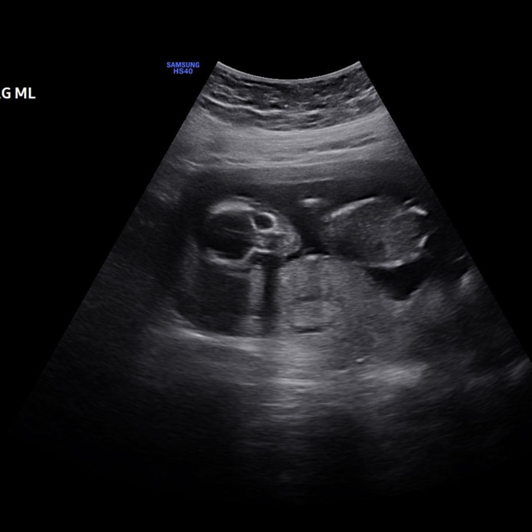 Photo shared by Amber for their Babylist baby registry.