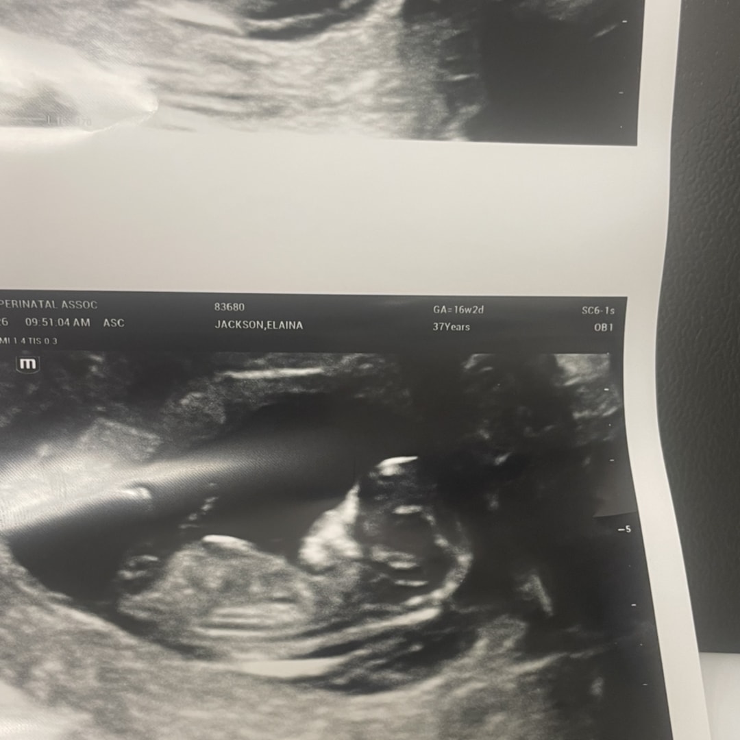 Photo shared by Elaina for their Babylist baby registry.