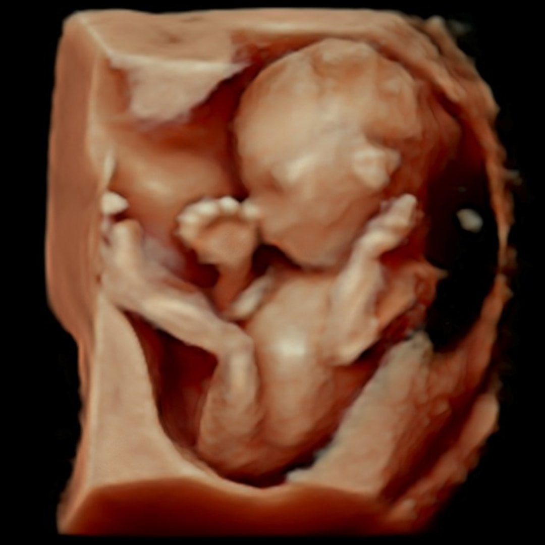 Photo shared by Julie for their Babylist baby registry.