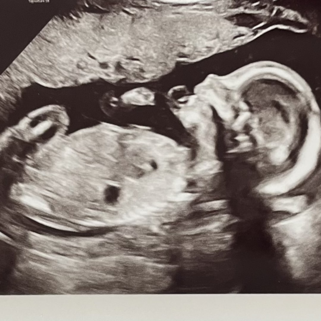 Photo shared by Samantha for their Babylist baby registry.
