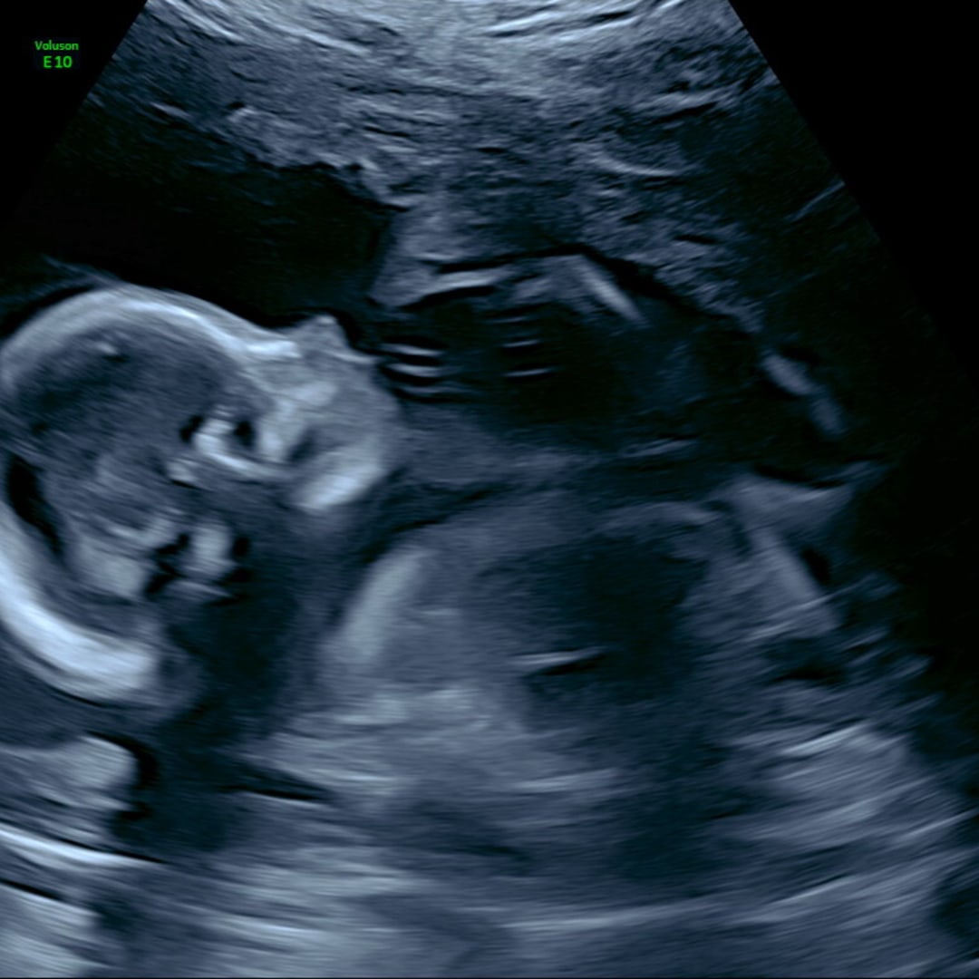Photo shared by Claudia for their Babylist baby registry.