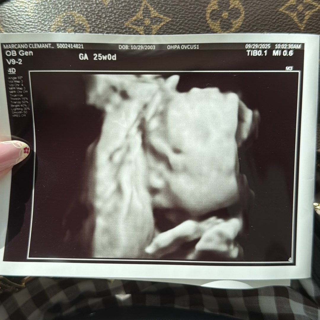 Photo shared by Anne for their Babylist baby registry.