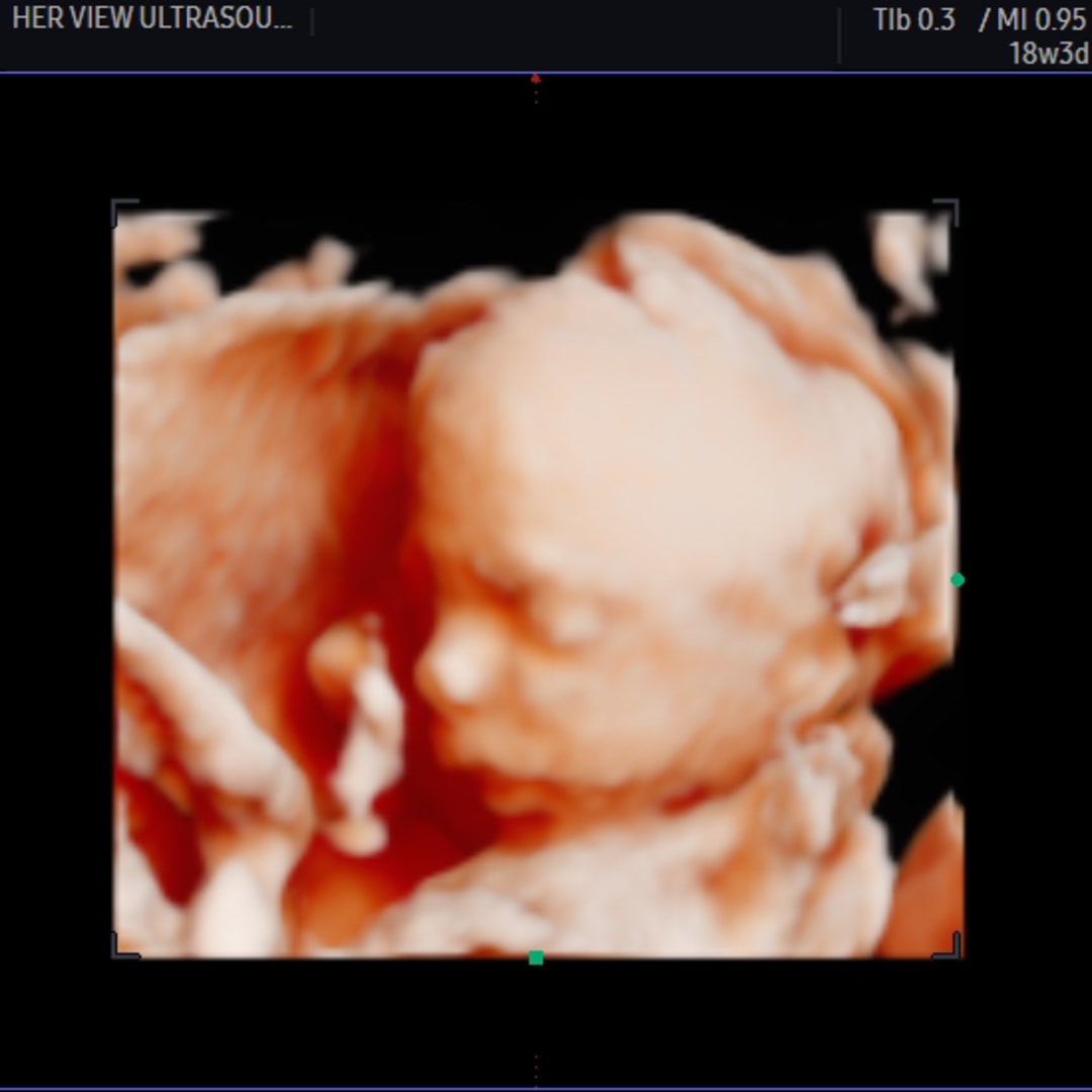 Photo shared by Melissa for their Babylist baby registry.