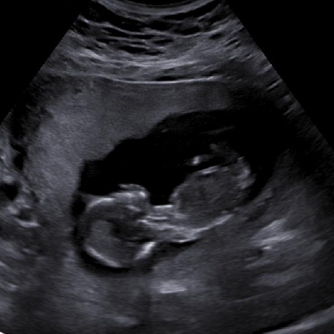 Photo shared by Melissa for their Babylist baby registry.