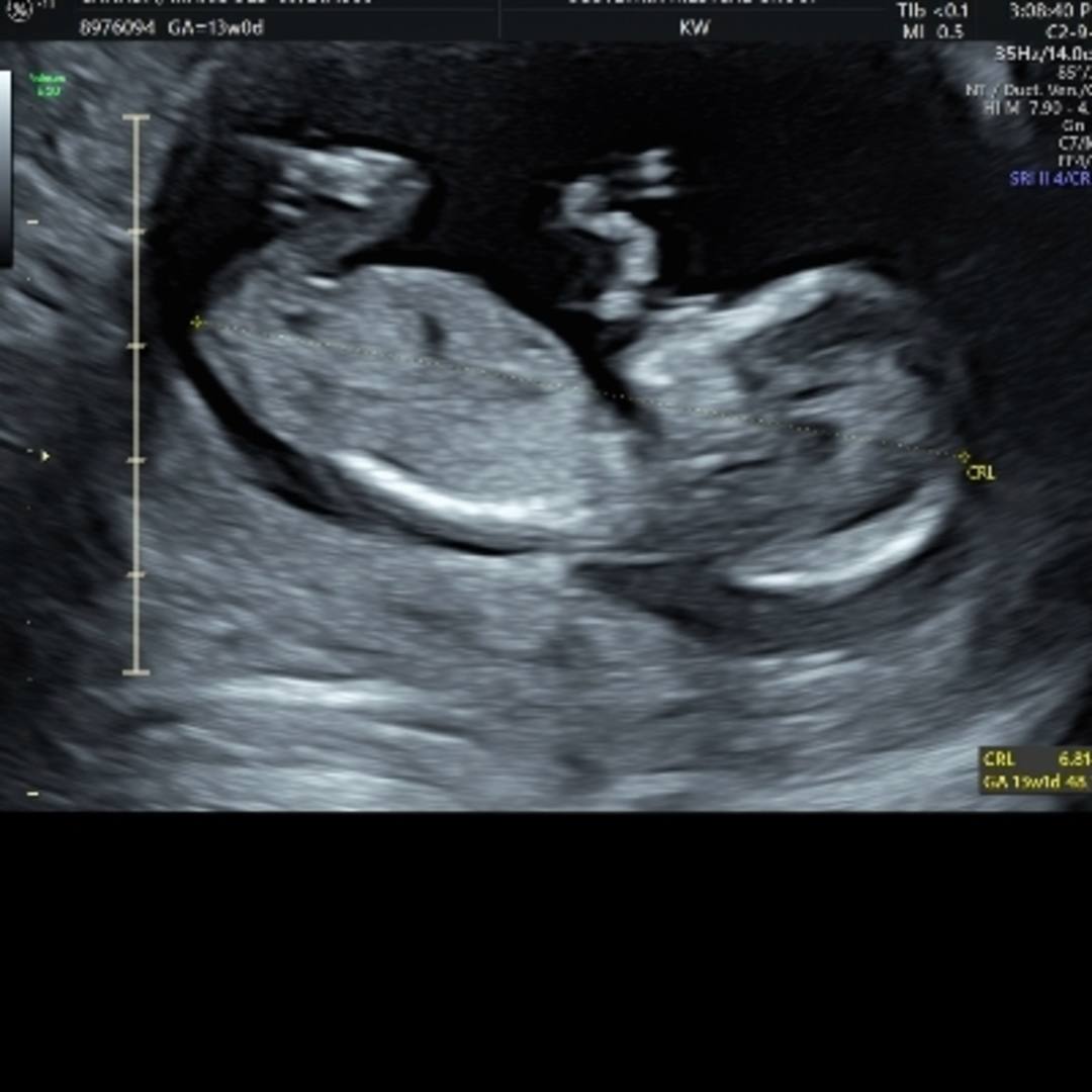 Photo shared by Maridole for their Babylist baby registry.