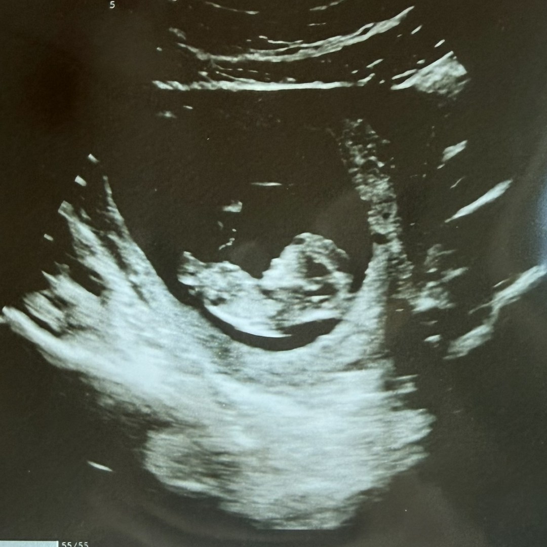 Photo shared by Addison for their Babylist baby registry.