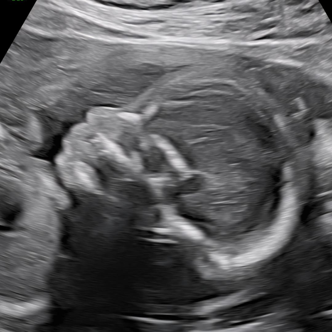 Photo shared by Kimberly for their Babylist baby registry.