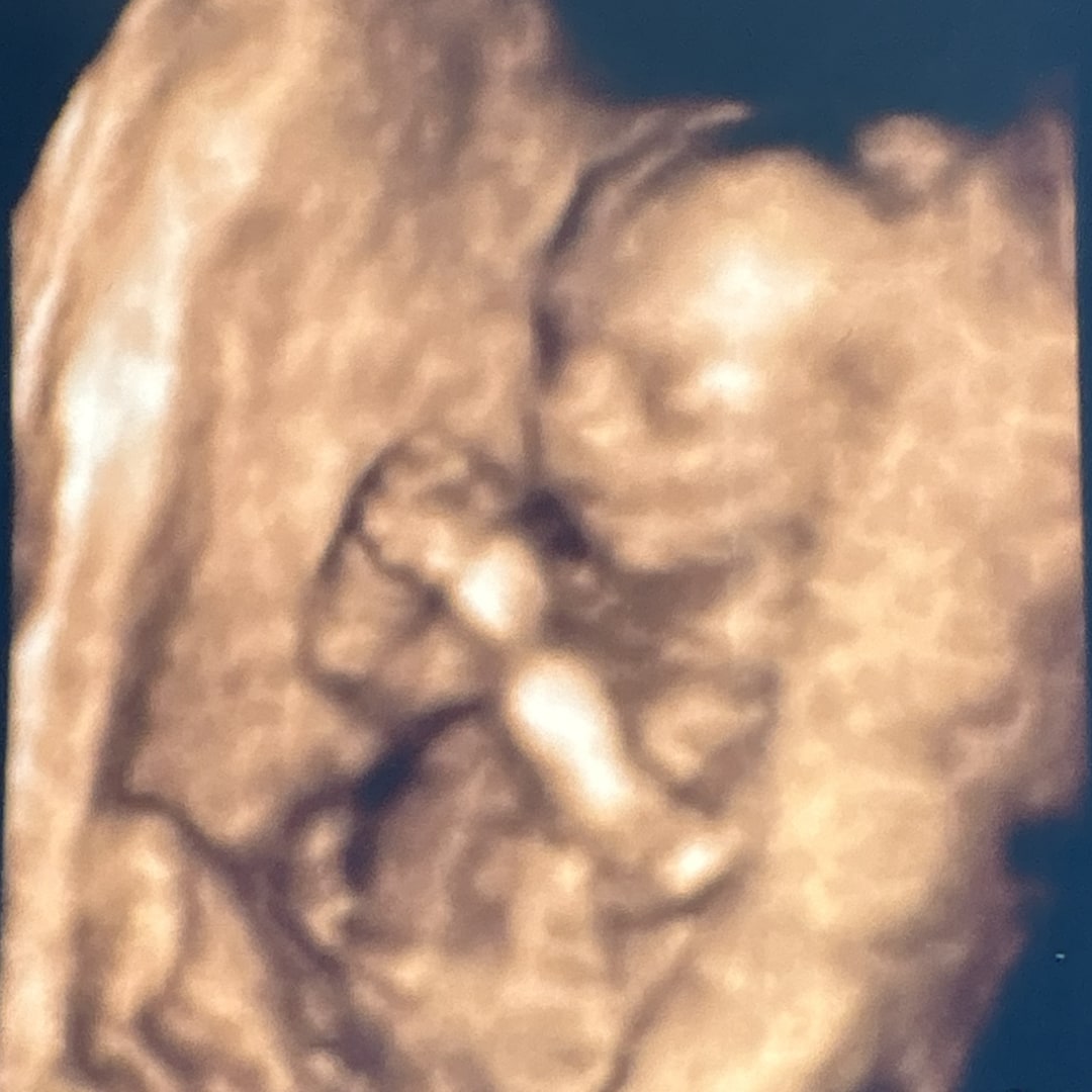 Photo shared by Alexis for their Babylist baby registry.