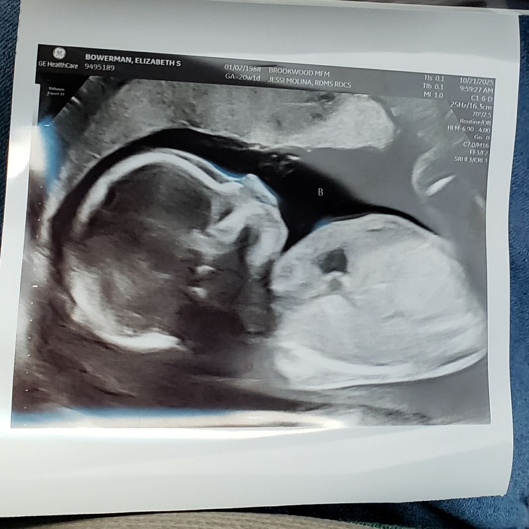 Photo shared by Sharee for their Babylist baby registry.