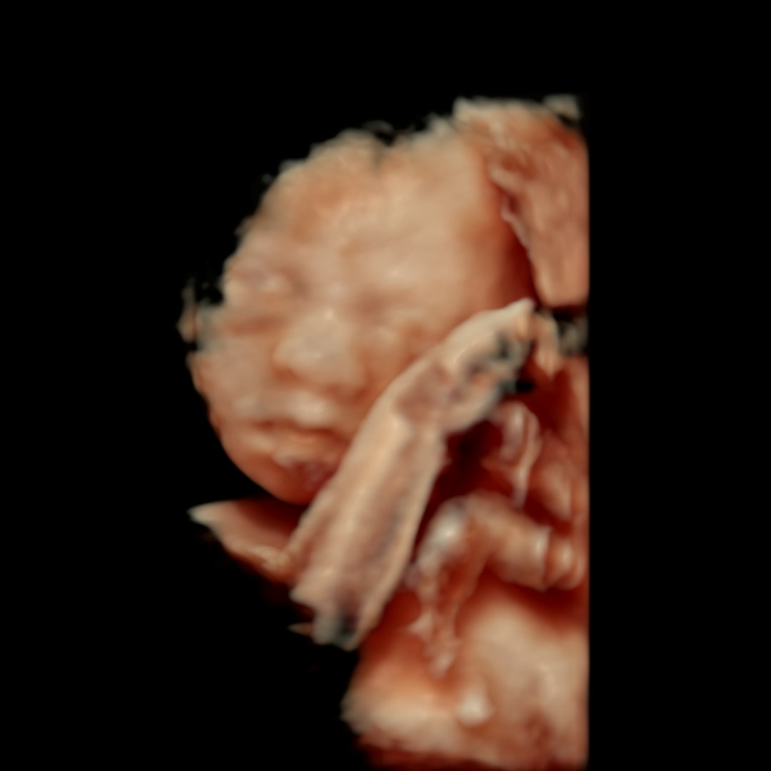 Photo shared by Zyrie for their Babylist baby registry.
