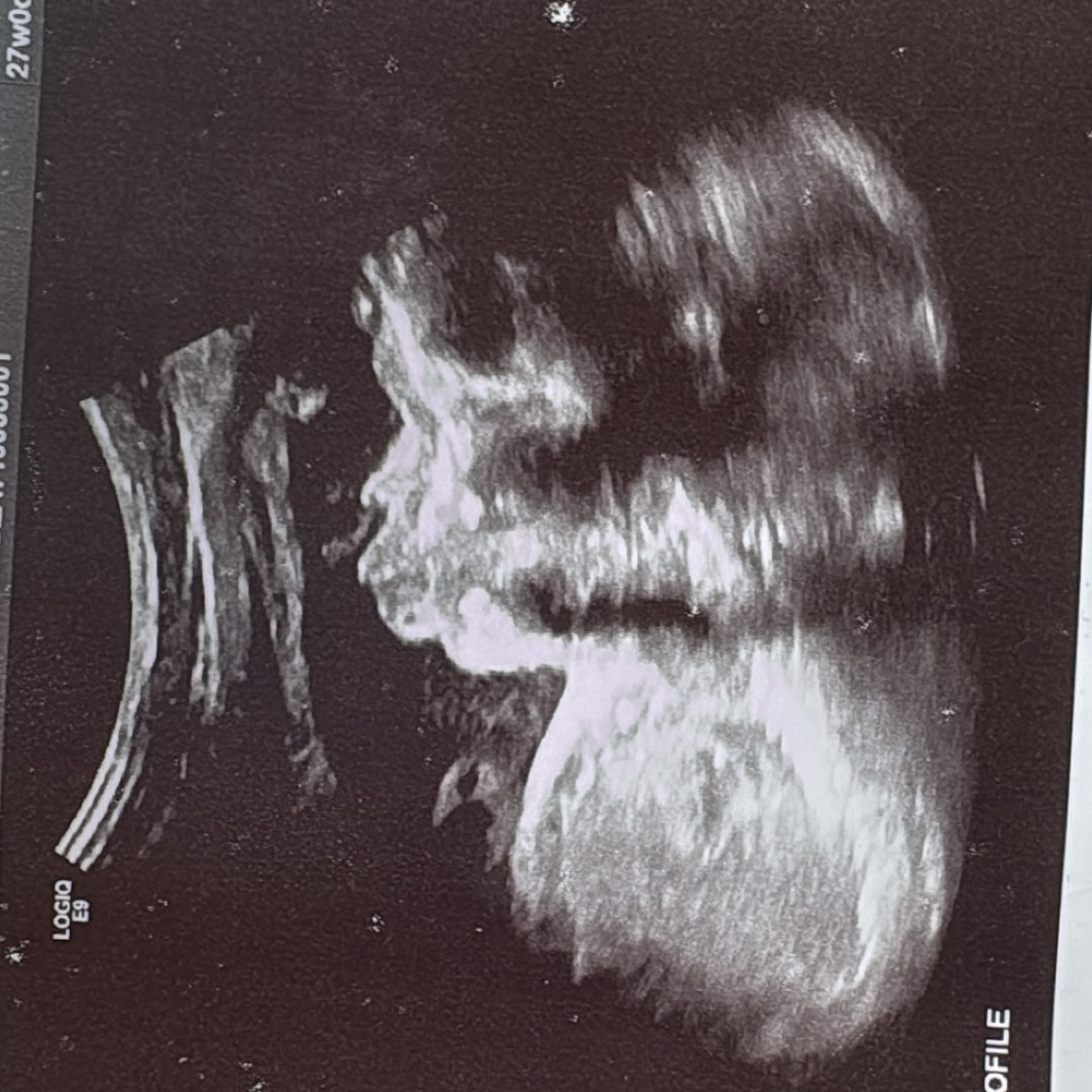 Photo shared by Kanauti for their Babylist baby registry.