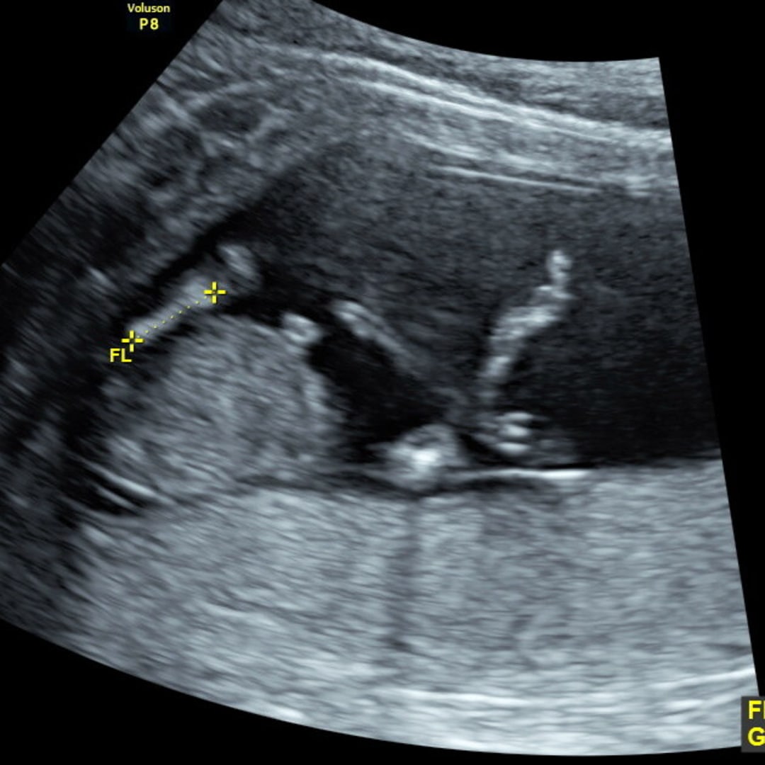 Photo shared by Emily for their Babylist baby registry.