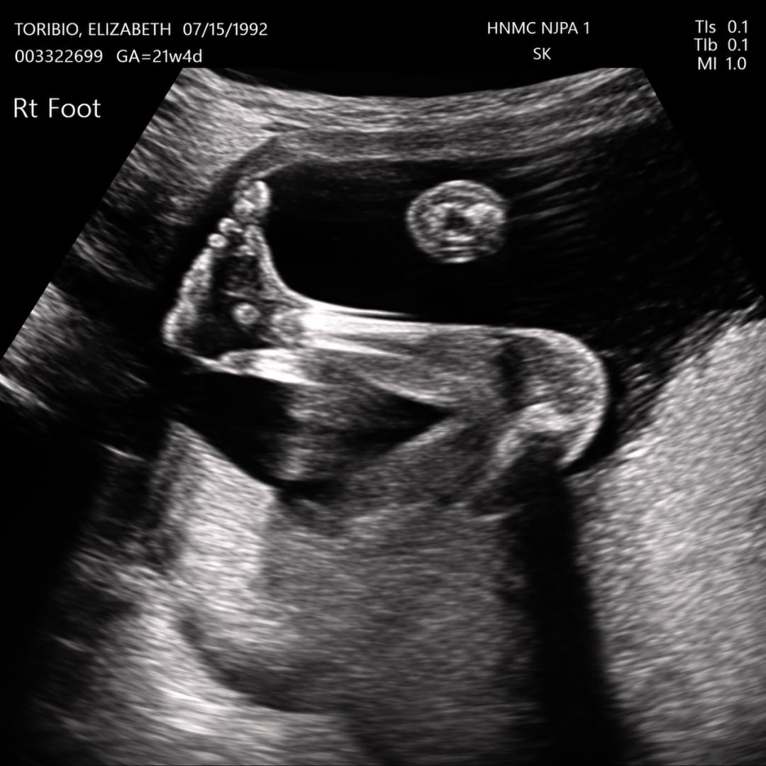 Photo shared by Elizabeth for their Babylist baby registry.