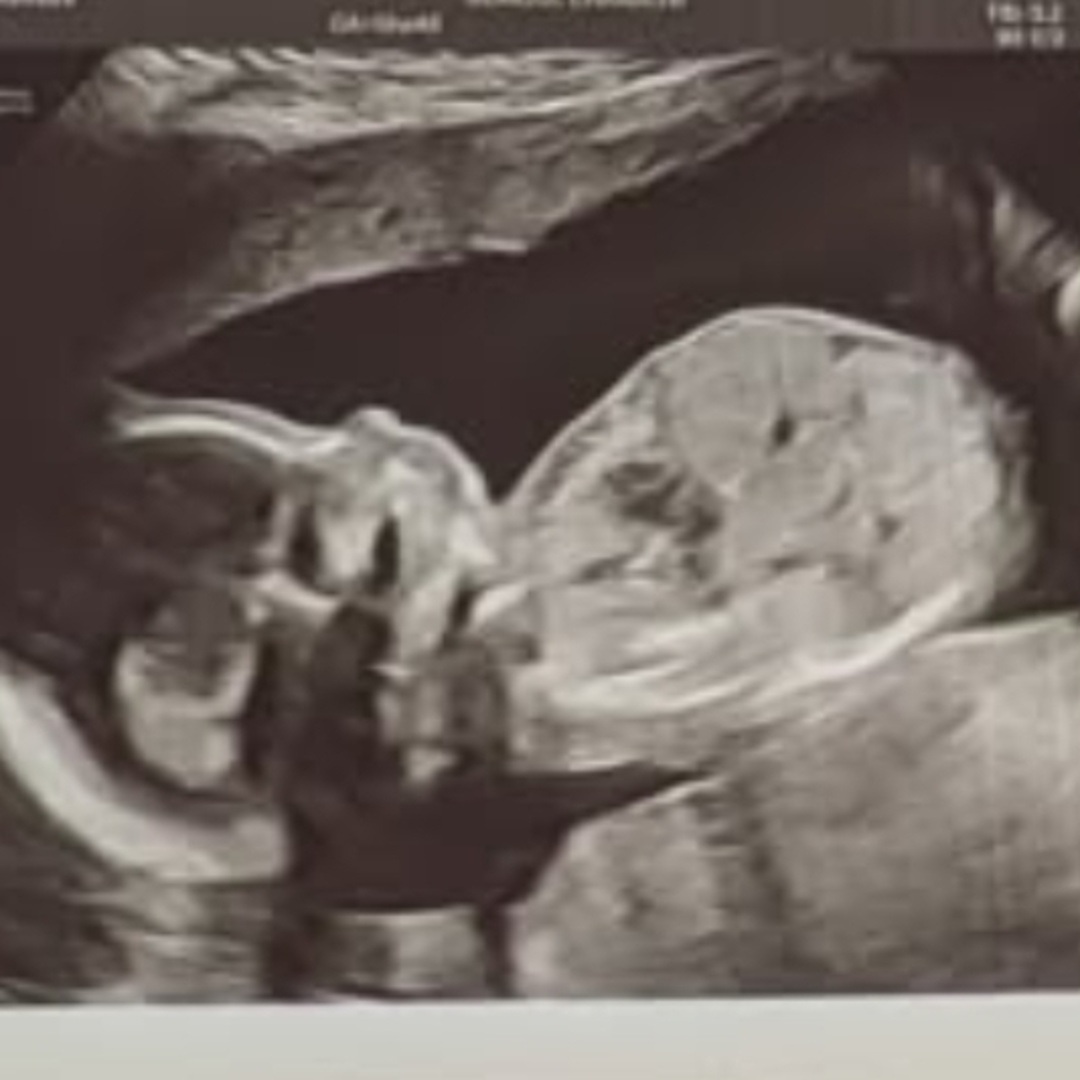 Photo shared by David for their Babylist baby registry.