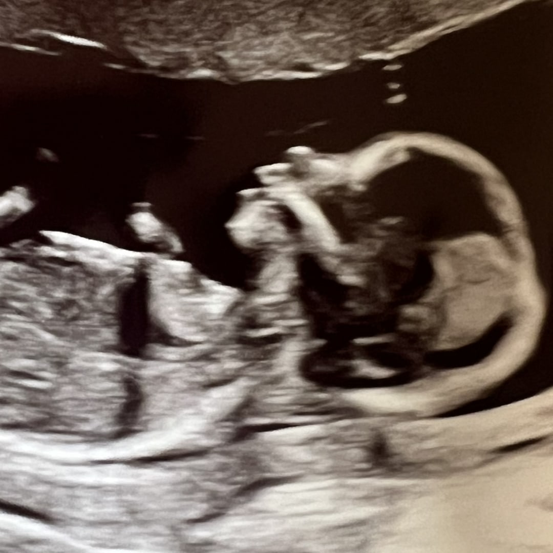 Photo shared by Jessica for their Babylist baby registry.