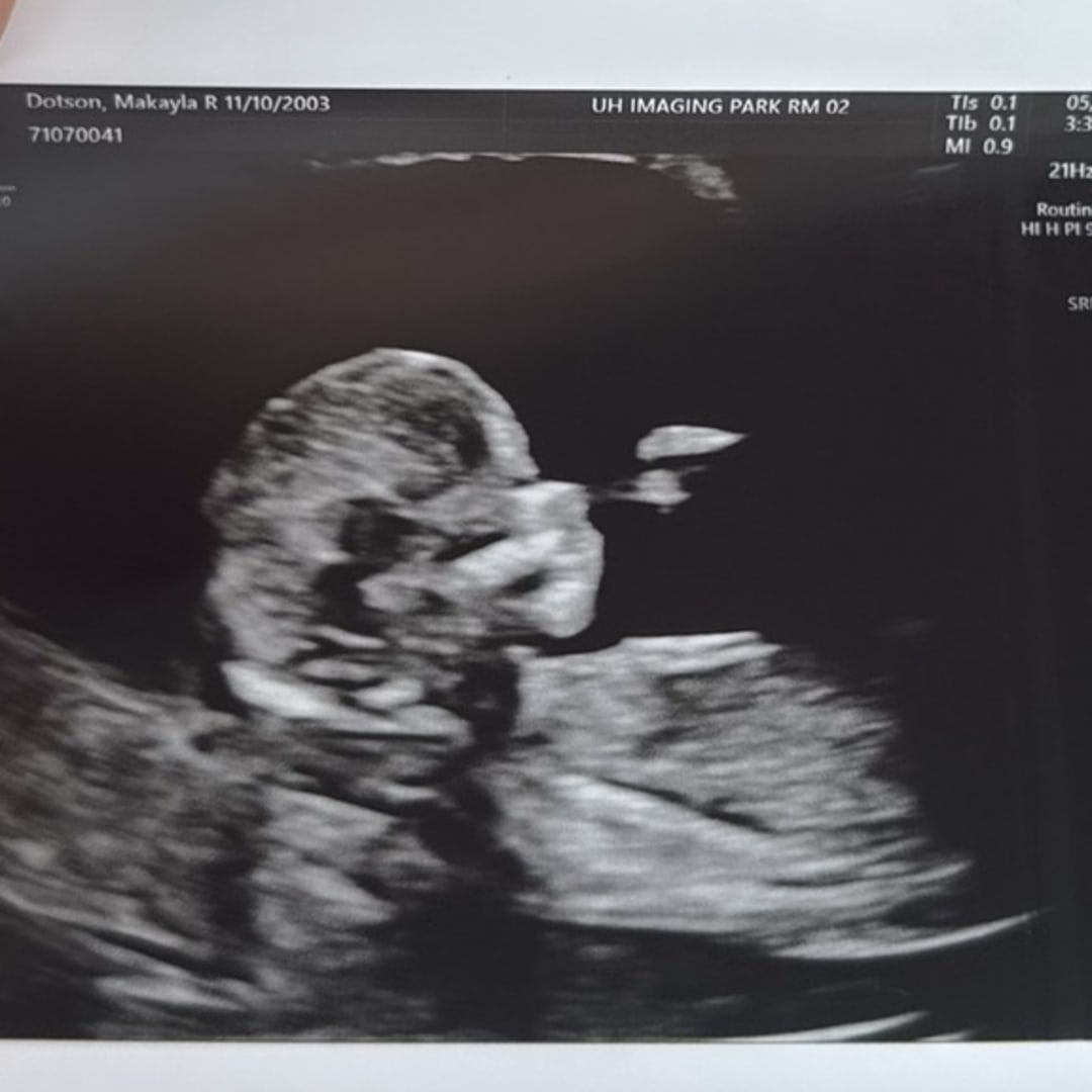 Photo shared by Makayla for their Babylist baby registry.